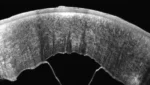 Oculus Pentacam Cornea OCT - Image 5