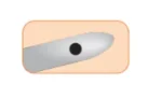 Surgistar Shahinian Lacrimal 23G Cannula Bullet Tip with Top Port (Box of 5)_extra_1