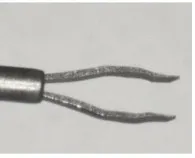 Vortex Surgical 25G ACTU8 Talon Pro-Grip Forceps (Box of 5)_extra_1